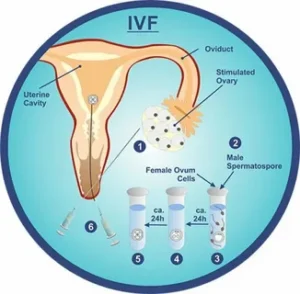 AI in Fertility vs Traditional Methods: A Data-Driven Comparison