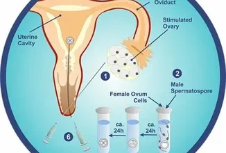 AI in Fertility vs Traditional Methods