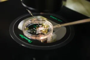 In Vitro Gametogenesis (IVG): The Future of Fertility and the Science of Creating Eggs and Sperm