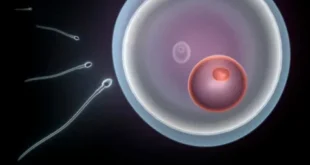 Can Contraception Make You Infertile