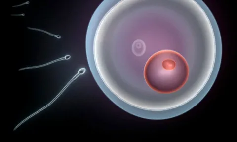 Can Contraception Make You Infertile
