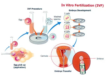 Ontological choreography ivf science society fertility